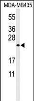 ZCH24  (C-term)