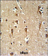 Rabbit Polyclonal Antibody to ZCH24  (C-term)