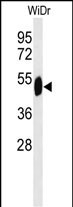 SETD6