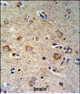 Rabbit Polyclonal Antibody to SETD6