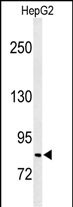 C19orf21 (N-term)