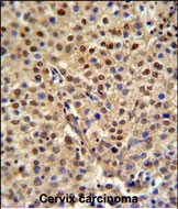 Rabbit Polyclonal Antibody to C19orf21 (N-term)