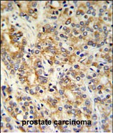 Rabbit Polyclonal Antibody to TXNDC12