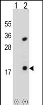 Rabbit Polyclonal Antibody to PLA2G1B