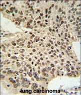 Rabbit Polyclonal Antibody to HIST1H2AL