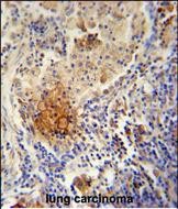 Rabbit Polyclonal Antibody to TYROBP