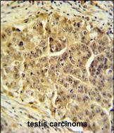 Rabbit Polyclonal Antibody to CDC45L