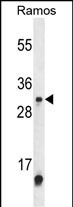 METTL1
