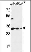PYCR1