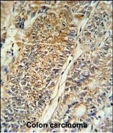 Rabbit Polyclonal Antibody to PYCR1