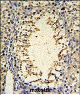 Rabbit Polyclonal Antibody to IMP3