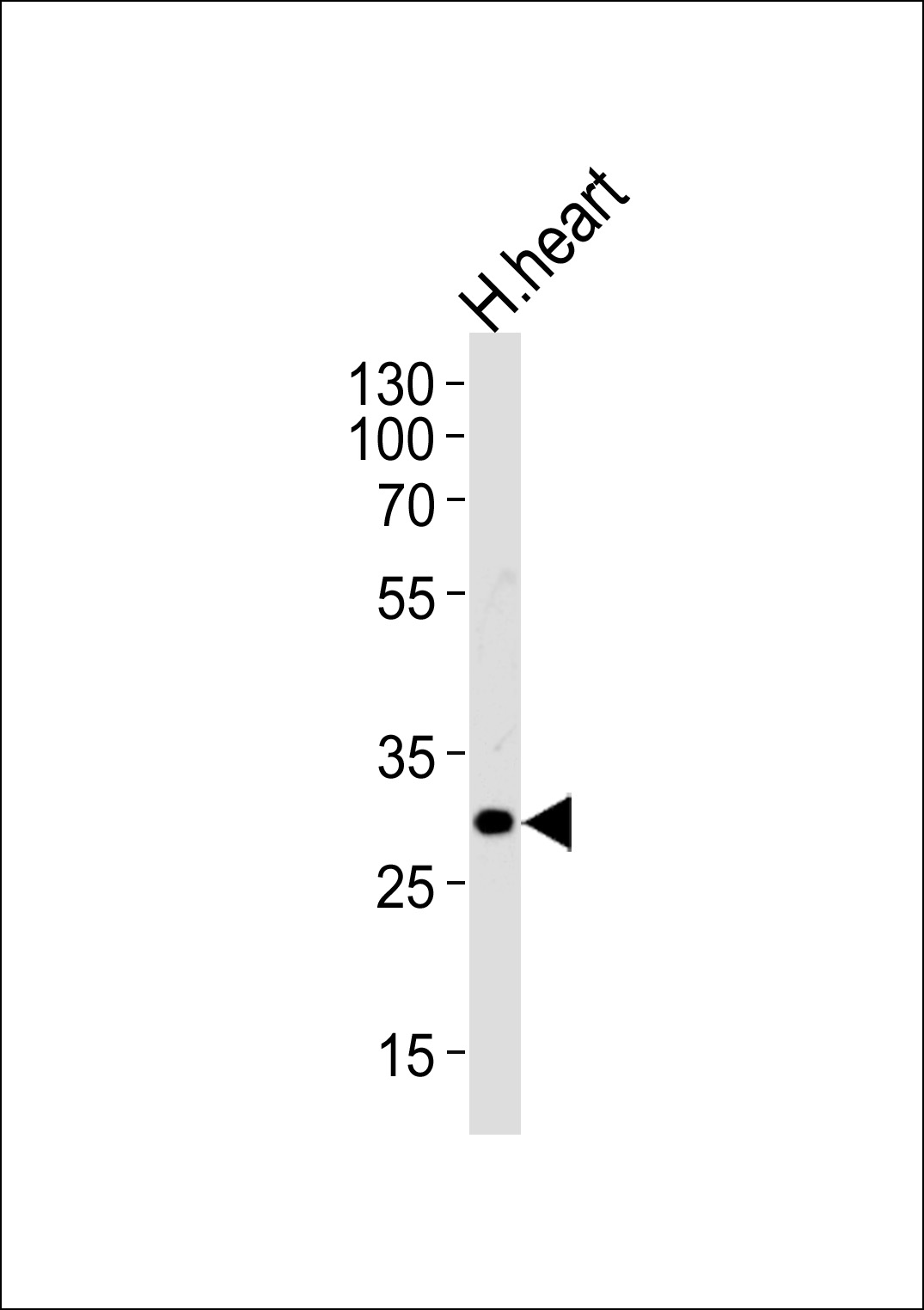 TBCD7