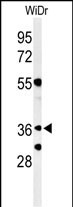 NSE4A (N-term)