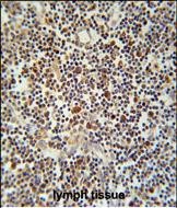 Rabbit Polyclonal Antibody to CLM1 (N-term)