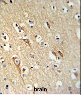 Rabbit Polyclonal Antibody to ALG10 (N-term)