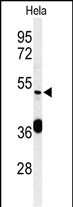 DDX49