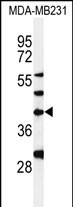 DPAGT1
