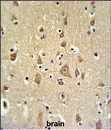 Rabbit Polyclonal Antibody to FAM44B