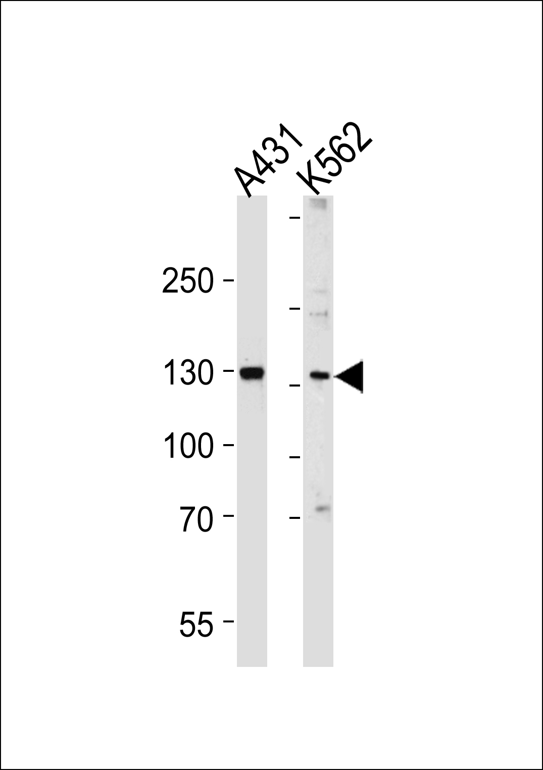 GALNT5 (N-term)