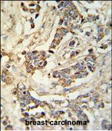 Rabbit Polyclonal Antibody to MRAP (N-term)