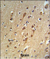 Rabbit Polyclonal Antibody to URG4