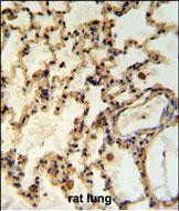 Rabbit Polyclonal Antibody to IMP2L