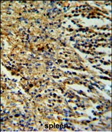Rabbit Polyclonal Antibody to PHTNS (N-term)