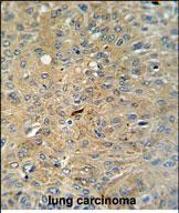 Rabbit Polyclonal Antibody to Cleaved-CASP3 (Asp175)