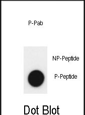 Phospho-JMJD2A(Y547)