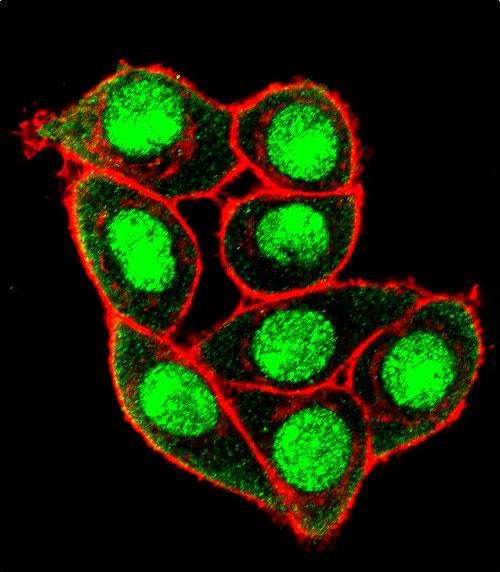 Rabbit Polyclonal Antibody to Phospho-MUC1(T1224)
