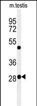 RPC8 (N-term)