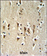 Rabbit Polyclonal Antibody to KCTD1  (C-term)