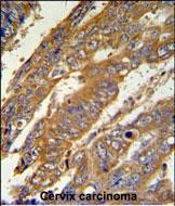 Rabbit Polyclonal Antibody to PAN3  (C-term)