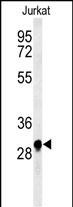 ANR49