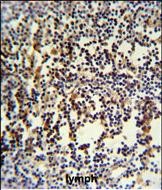 Rabbit Polyclonal Antibody to ANR49