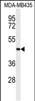 CC50B  (N-term)