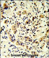 Rabbit Polyclonal Antibody to CC50B  (N-term)