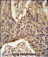 Rabbit Polyclonal Antibody to LPPR4  (C-term)