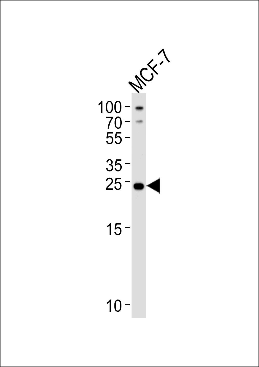 PTPLB  (C-term)