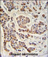 Rabbit Polyclonal Antibody to ATHL1