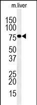 IN80D  (N-term)