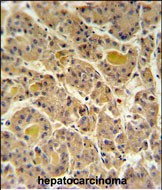 Rabbit Polyclonal Antibody to IN80D  (N-term)