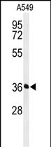 PAAF1 (N-term)
