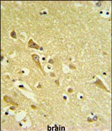 Rabbit Polyclonal Antibody to PAAF1 (N-term)