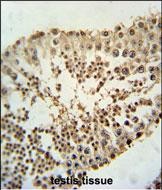 Rabbit Polyclonal Antibody to RIMKLB (N-term)