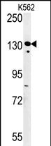 SMARCC1 (N-term)