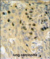 Rabbit Polyclonal Antibody to SMARCC1 (N-term)