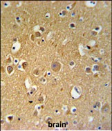 Rabbit Polyclonal Antibody to TUBB2C