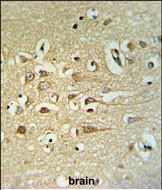 Rabbit Polyclonal Antibody to FA40B (N-term)