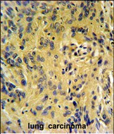 Rabbit Polyclonal Antibody to TESC
